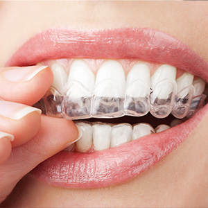 Dentistry for Life | Pediatric Dentistry, Implant Dentistry and All-on-4 reg