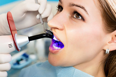 Dentistry for Life | Dental Fillings, Oral Cancer Screening and Periodontal Treatment