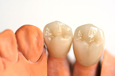 Dentistry for Life | Emergency Treatment, Preventative Program and Periodontal Treatment