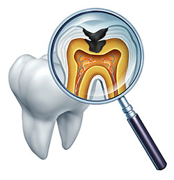 Dentistry for Life | Teeth Whitening, Dentures and Dental Bridges