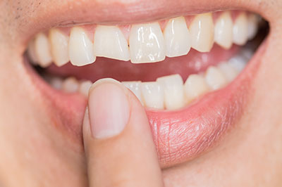 Dentistry for Life | Emergency Treatment, Extractions and Oral Exams