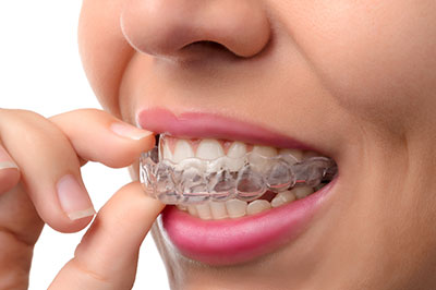 Dentistry for Life | Dentures, Veneers and Oral Exams