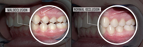 Dentistry for Life | TMJ Disorders, Oral Exams and Digital Radiography