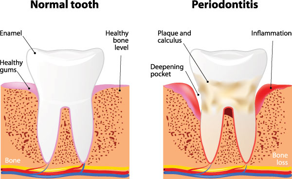 Dentistry for Life | Pediatric Dentistry, Teeth Whitening and Dentures