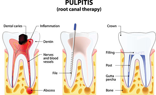 Dentistry for Life | Oral Cancer Screening, All-on-4 reg  and Veneers