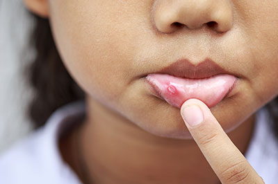Dentistry for Life | Dental Fillings, Dental Cleanings and Oral Cancer Screening
