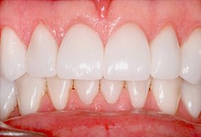 Dentistry for Life | Periodontal Treatment, Crowns and Emergency Treatment